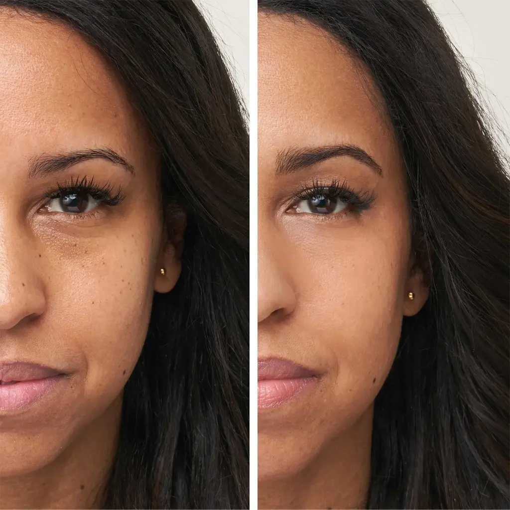 Enlighten Concealer™ 