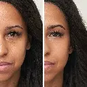 Enlighten Concealer™ 